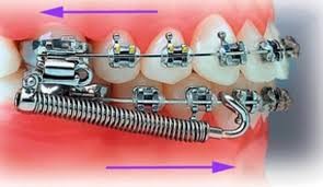 diorthosi_orthodontikos11.jpg