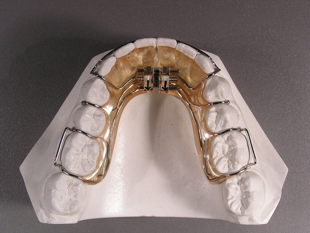 prosthiadontia_orthodontikos.jpg