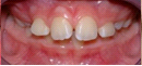 tooth child2