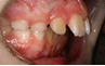 tooth child3